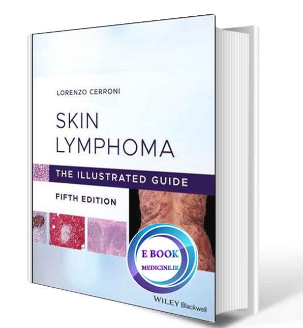 دانلود کتاب Skin Lymphoma: The Illustrated Guide 2020 (ORIGINAL PDF)